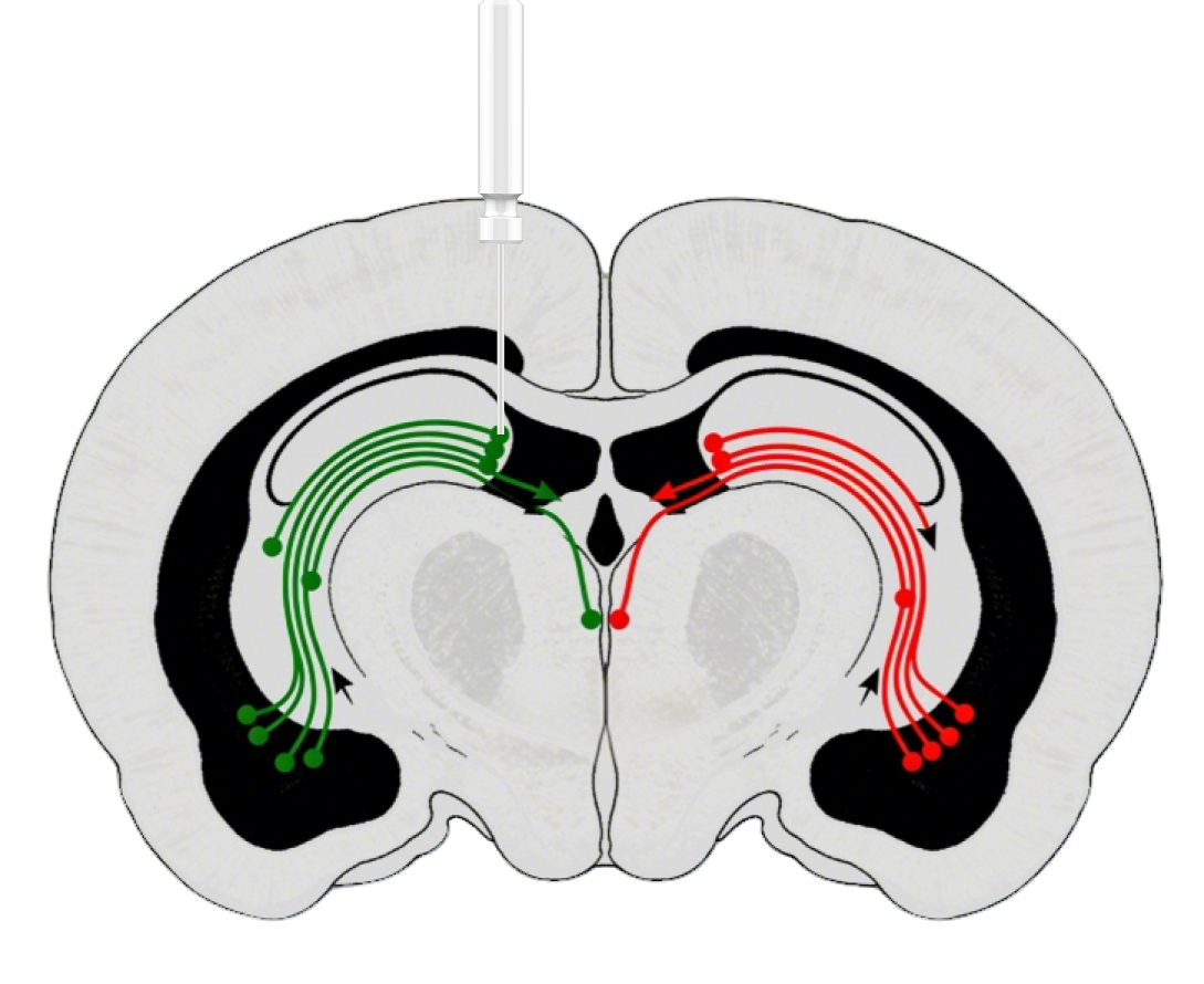Sensor expression and fiber cannula implant