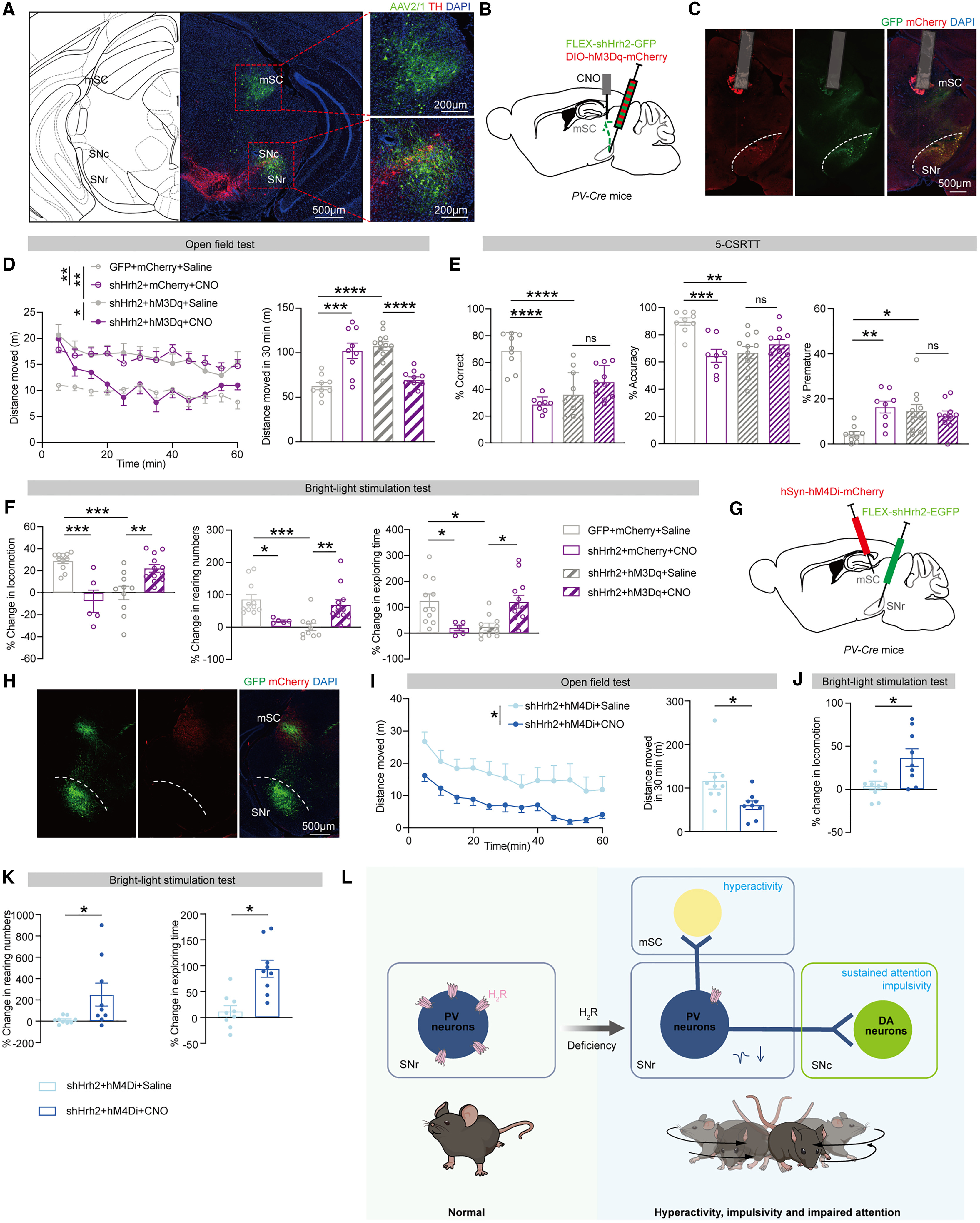Representative fluorescence images of viral expression and anatomical targeting in the SNr and medial superior colliculus (mSC)