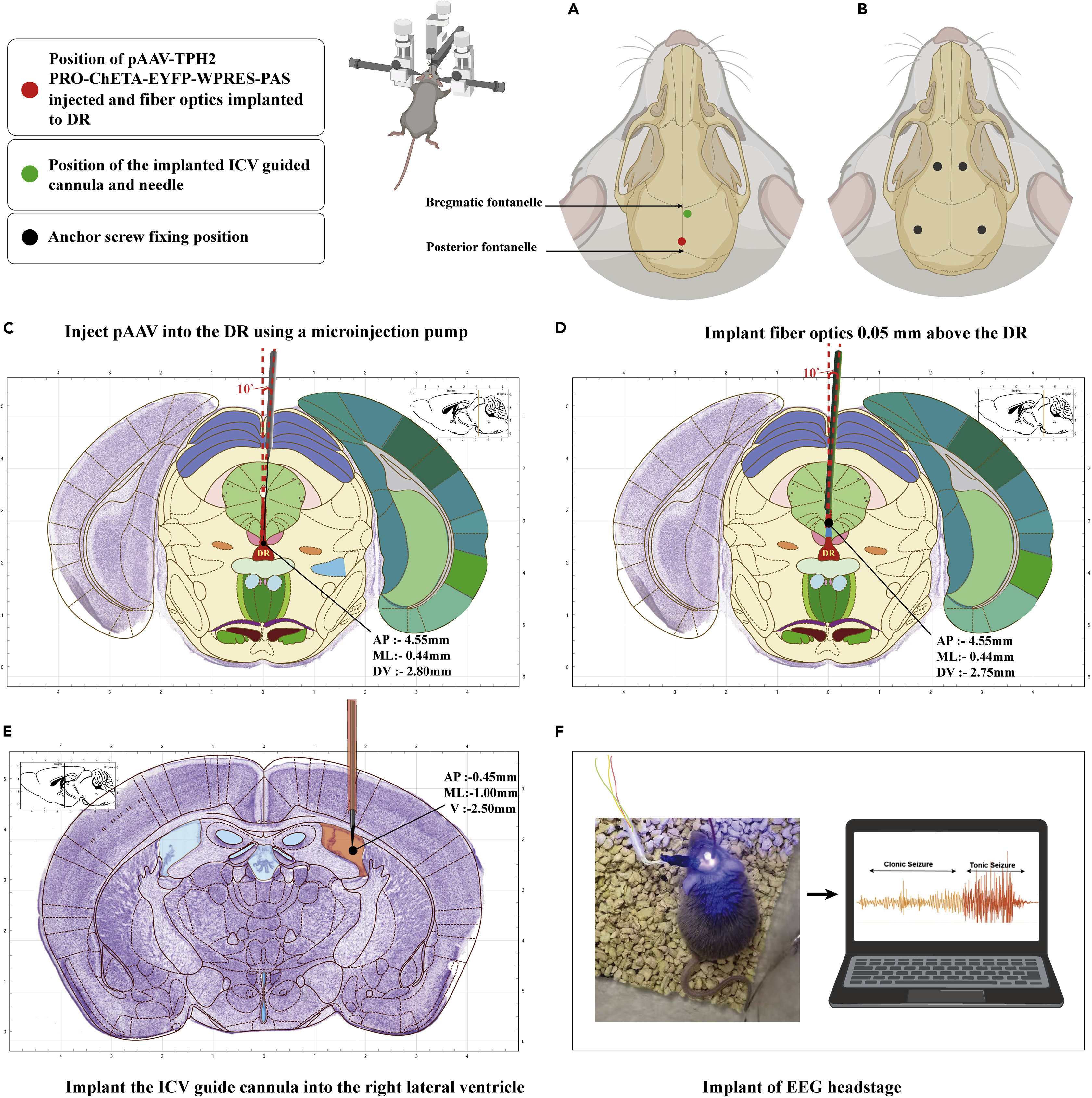 Schematic of blue-light photostimulation and EEG monitoring of clonic and tonic seizures in DBA/1 mice