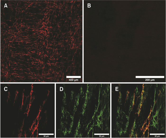 Original Figure2A field of red ChR2-associated cellular fluorescence in colonic muscularis