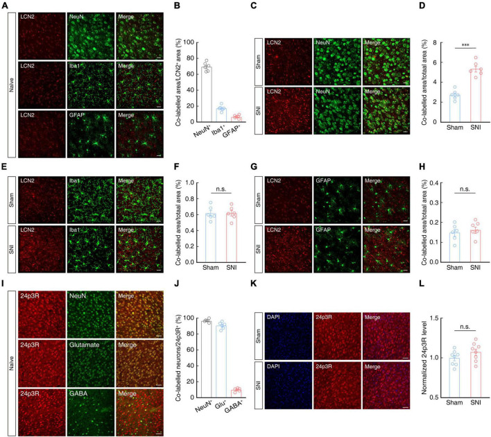 Original Figure 5C detail: overlapping LCN2 and neuronal-marker fluorescence in ACC