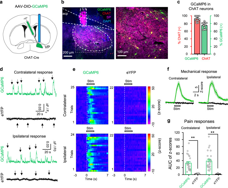 Original Figure 2b detail: merged fluorescence associated with ventral pallidal cholinergic cells