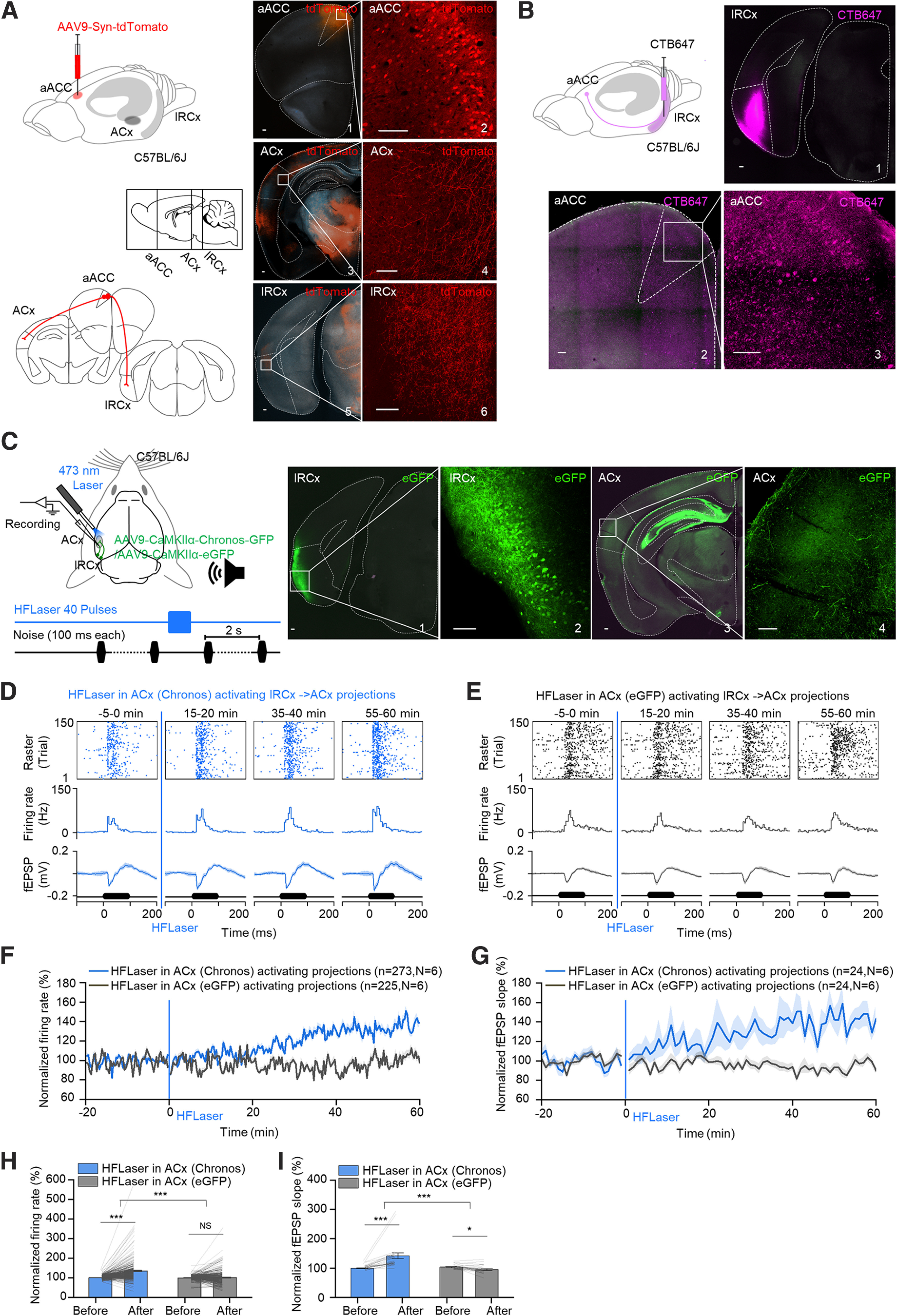 Original Figure 3C detail: green lRCx-derived projection fibers in auditory cortex